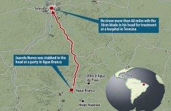 MAN DRIVES HIMSELF TO HOSPITAL WITH BUTCHER KNIFE IN HEAD (3)